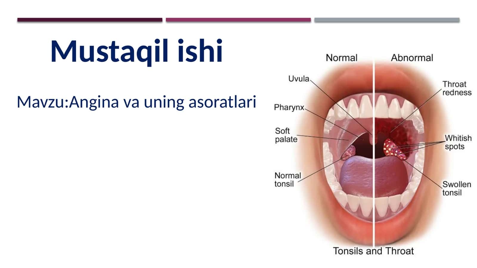 Angina va uning asoratlari 1