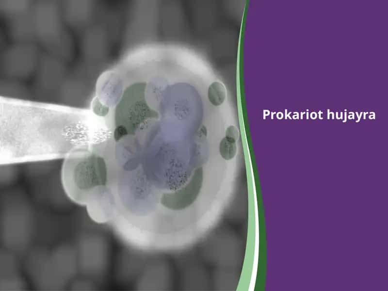 Prokariot hujayra 1