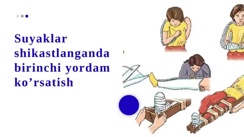 Suyaklar shikastlanganida birinchi yordam ko’rsatish 1