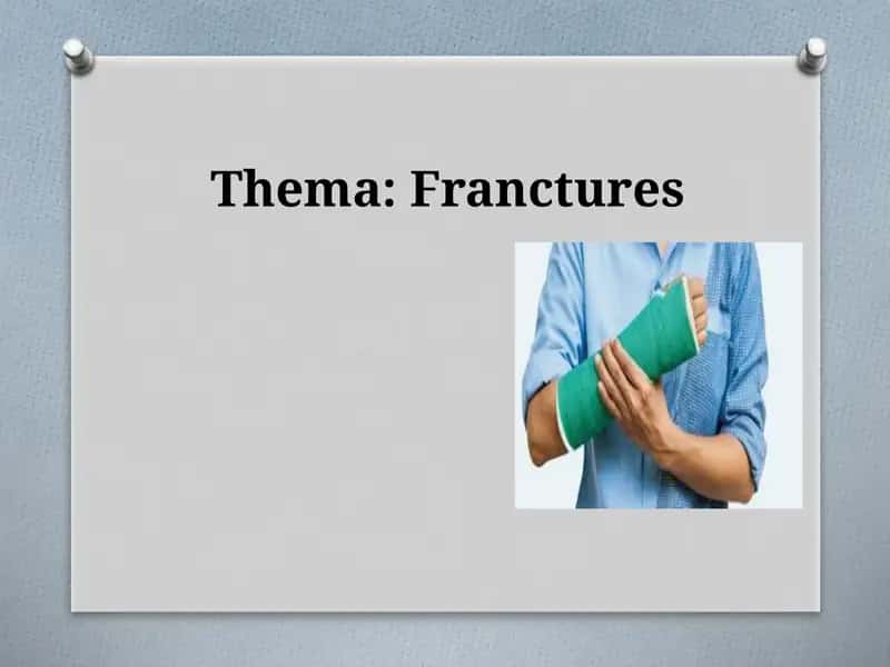 Bone fracture 1