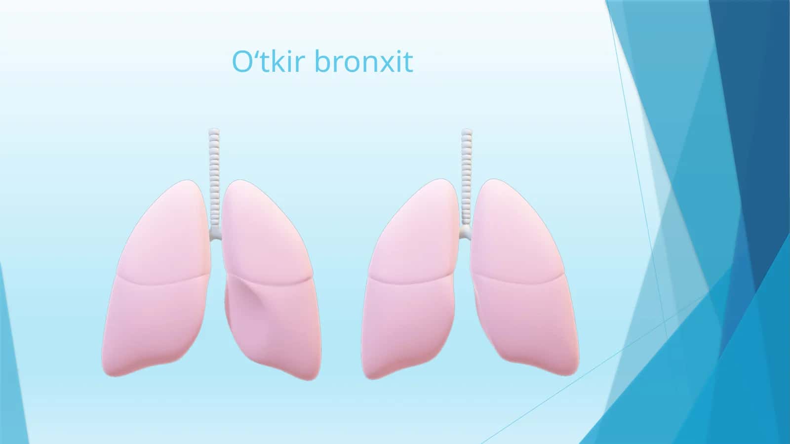 O‘tkirbronxit 1