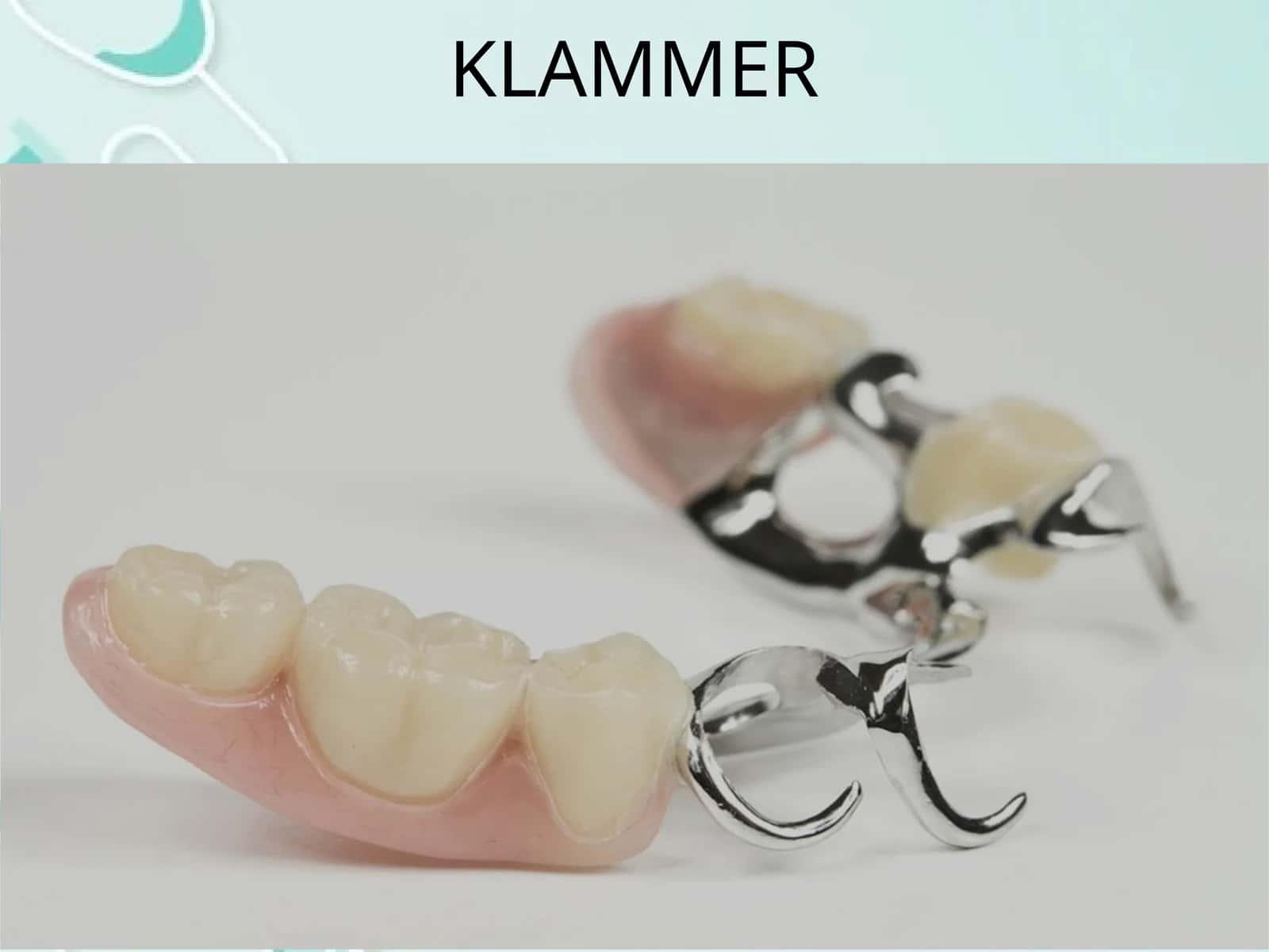 Klammer 1