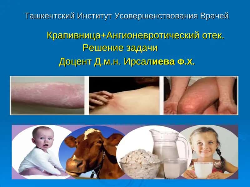 Крапивница 1
