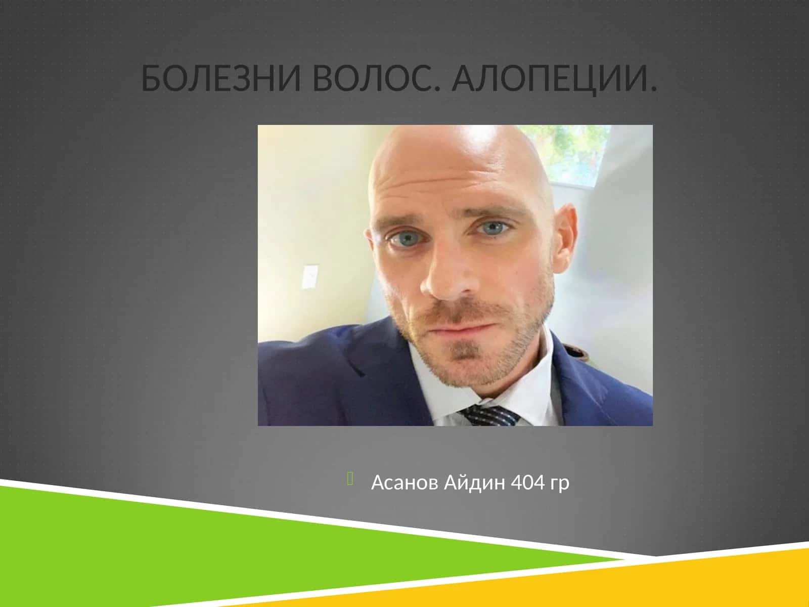 КЛАССИФИКАЦИЯ АЛОПЕЦИЙ 1