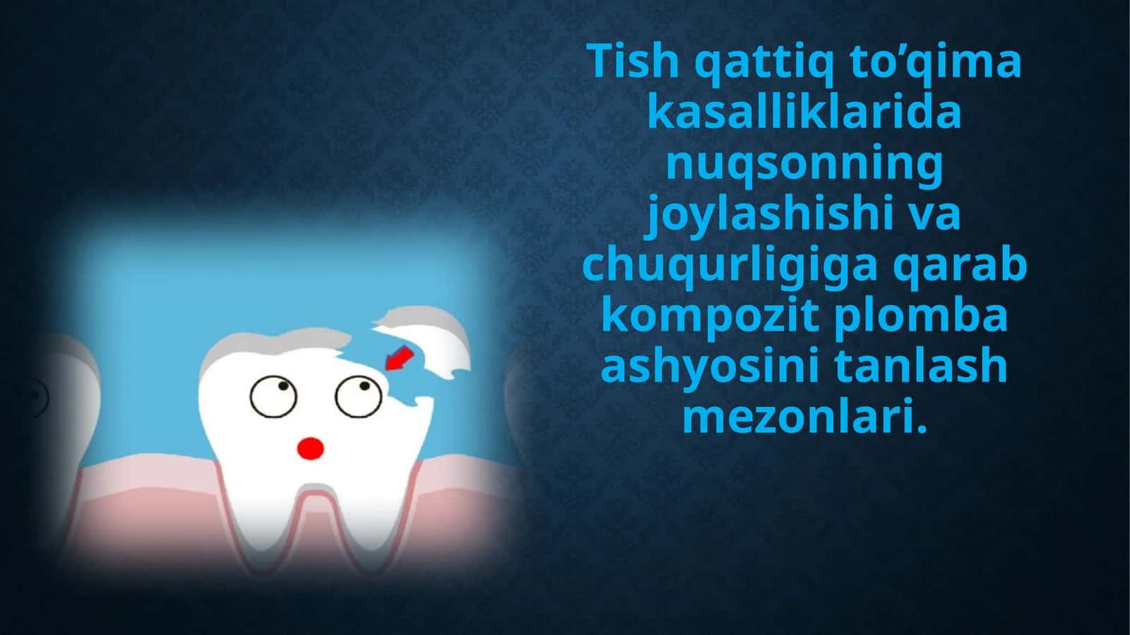 Tish qattiq to'qimalaridan nuqsonning joylashishi va chuqurligiga qarab kompozit plomba ashyosini tanlash mezonlari 1