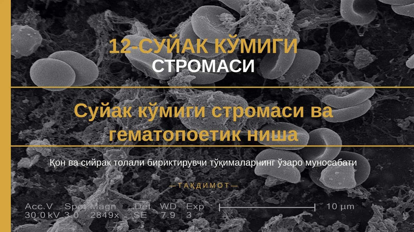 12-СУЙАК КЎМИГИ 1