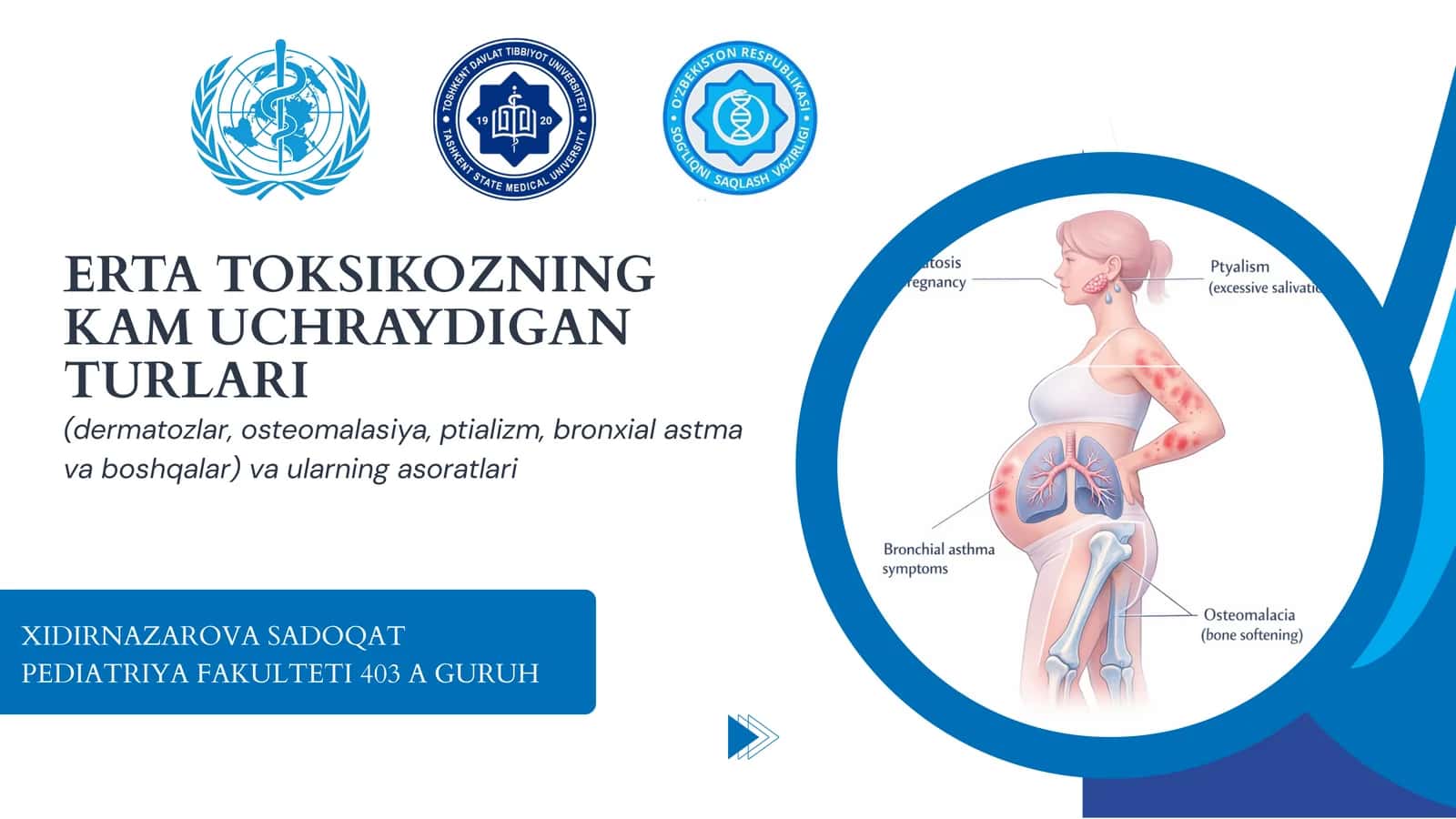 ERTA TOKSIKOZNING KAM UCHRAYDIGAN TURLARI 1