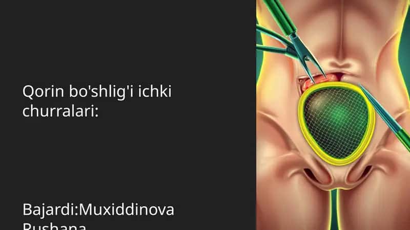 Qorin bo'shlig'i ichki churralari 1