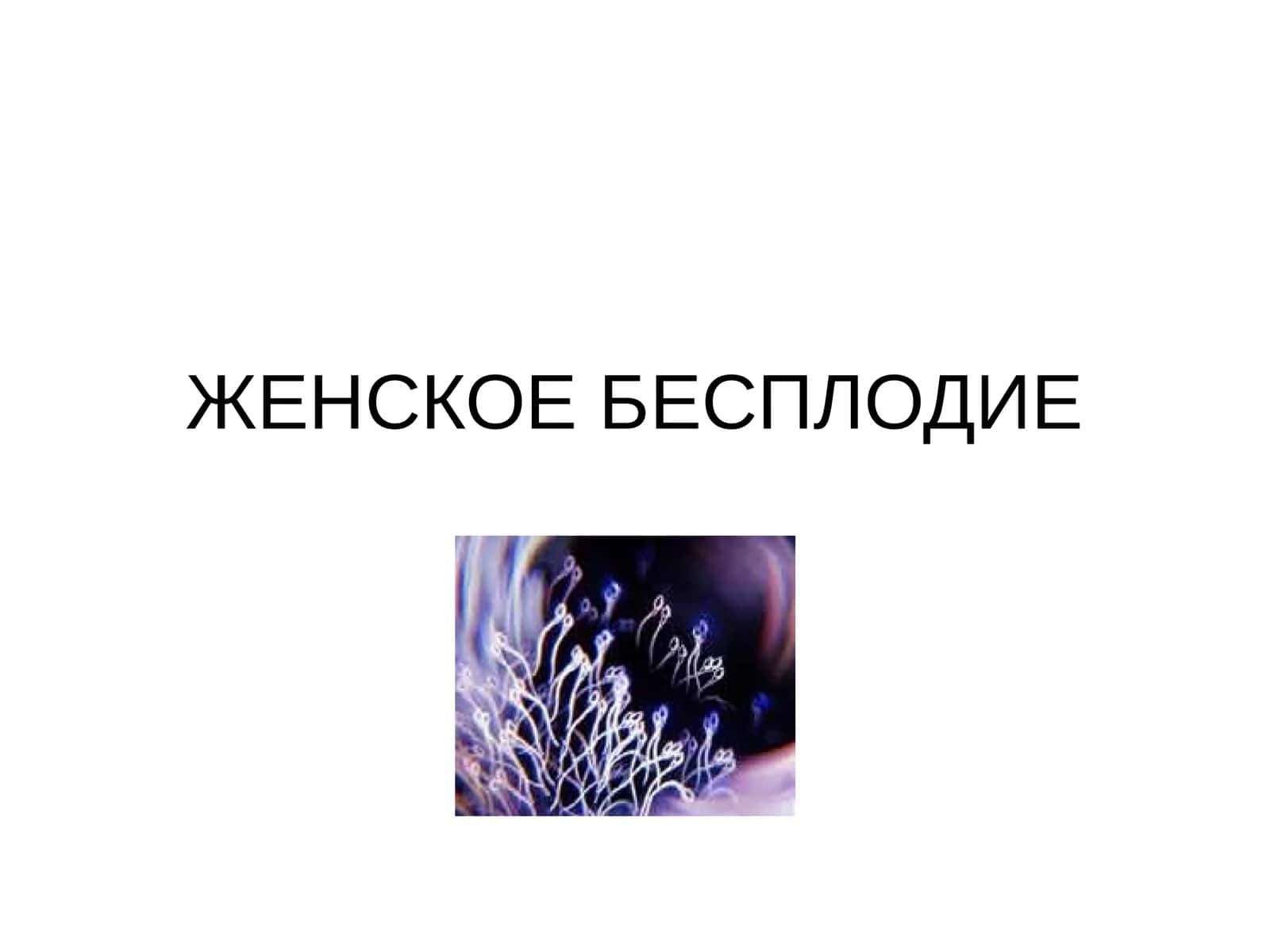 ЖЕНСКОЕ БЕСПЛОДИЕ 1