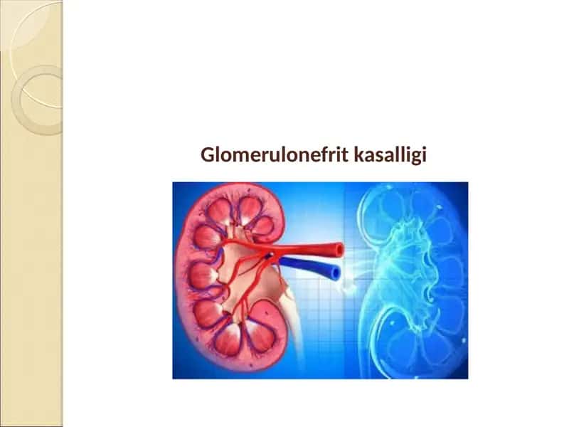 Glomerulonefrit kasalligi 1