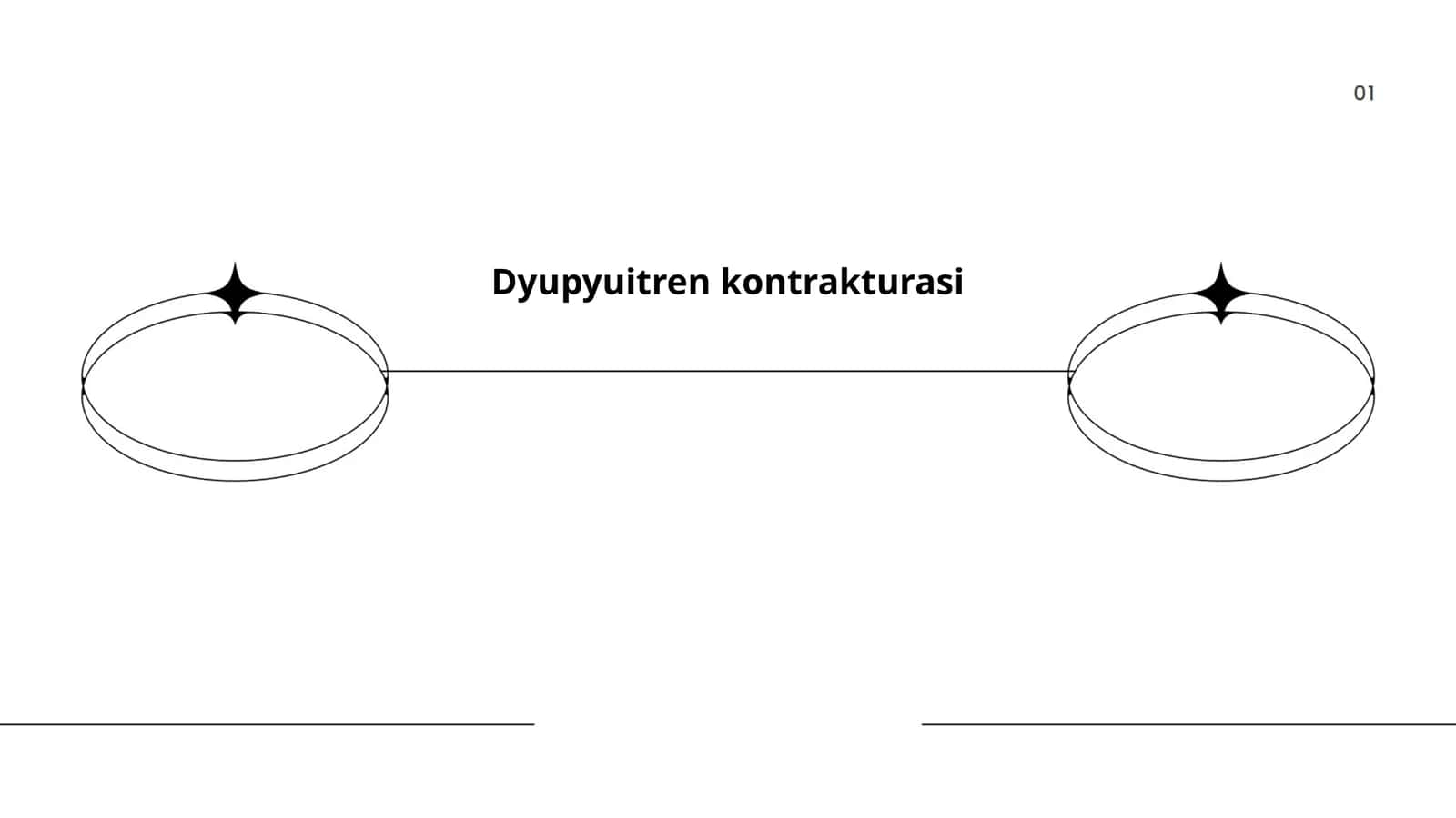 Dyupyuitren kontrakturasi 1