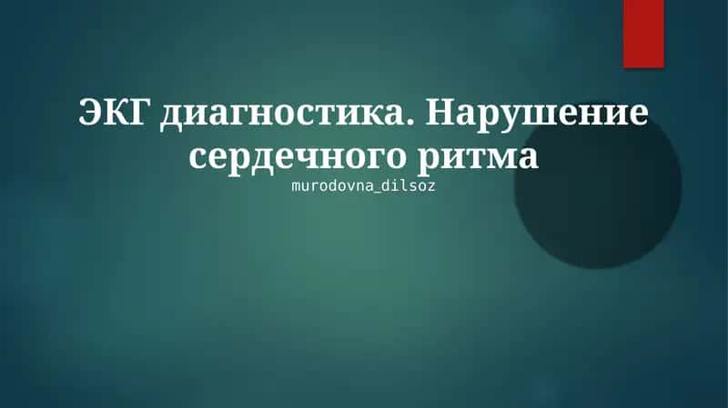 ЭКГ диагностика. Нарушение сердечного ритма 1