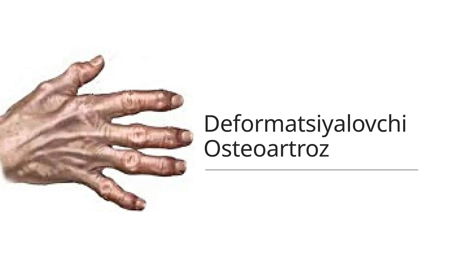 Deformatsiyalovchi Osteoartroz 1