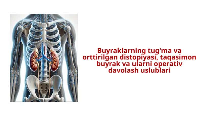 Buyraklarning tug'ma va orttirilgan distopiyasi, taqasimon buyrak va ularni operativ davolash uslublari 1