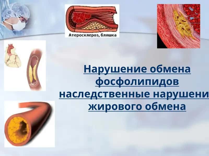 Нарушение обмена фосфолипидов наследственные нарушение жирового обмена 1