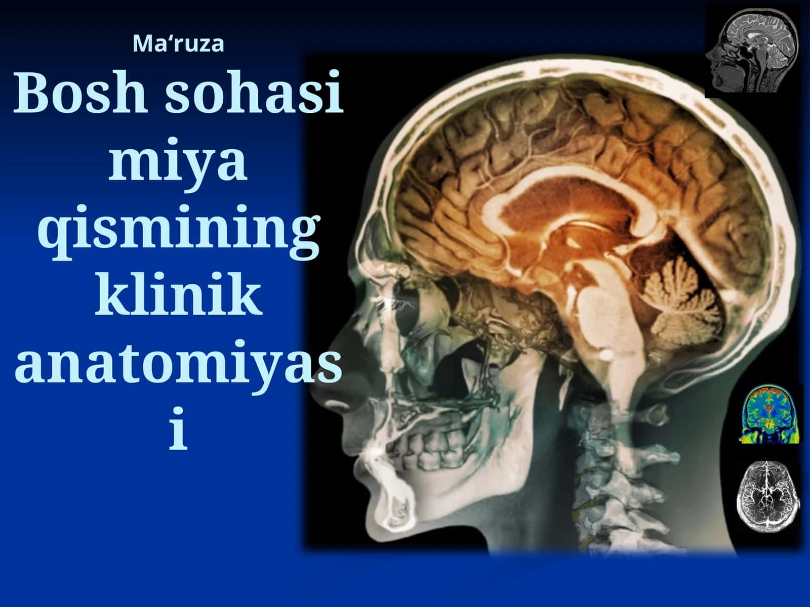 Maʻruza Bosh sohasi miya qismining klinika anatomiyasi 1