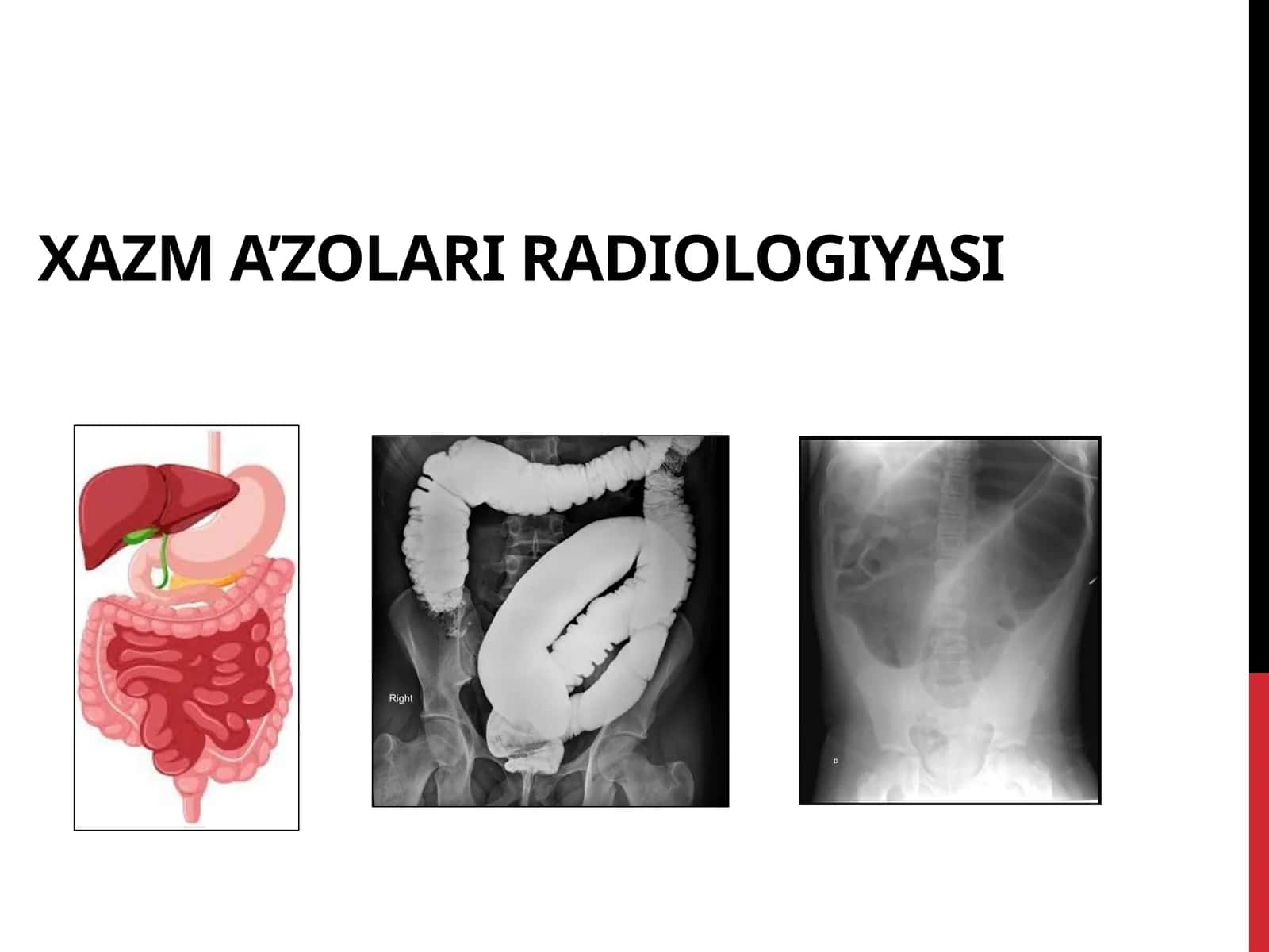 XAZM A’ZOLARI RADIOLOGIYASI 1