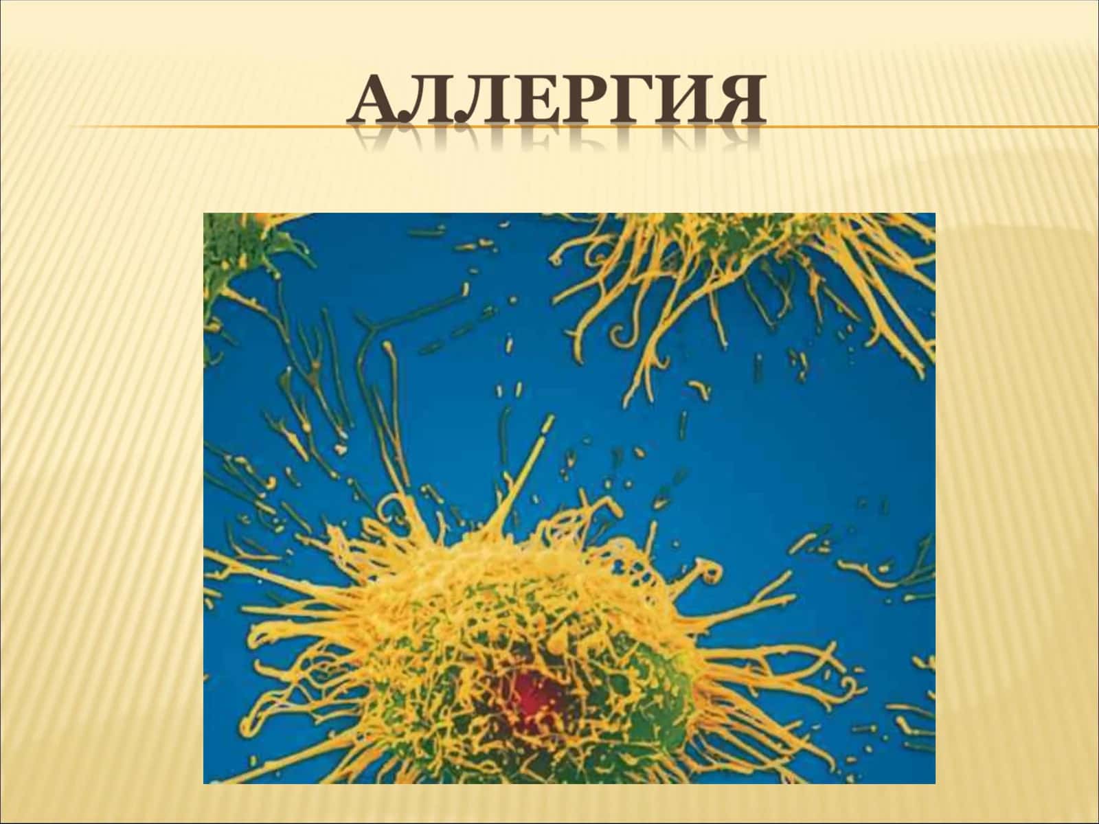 Аллергия 1