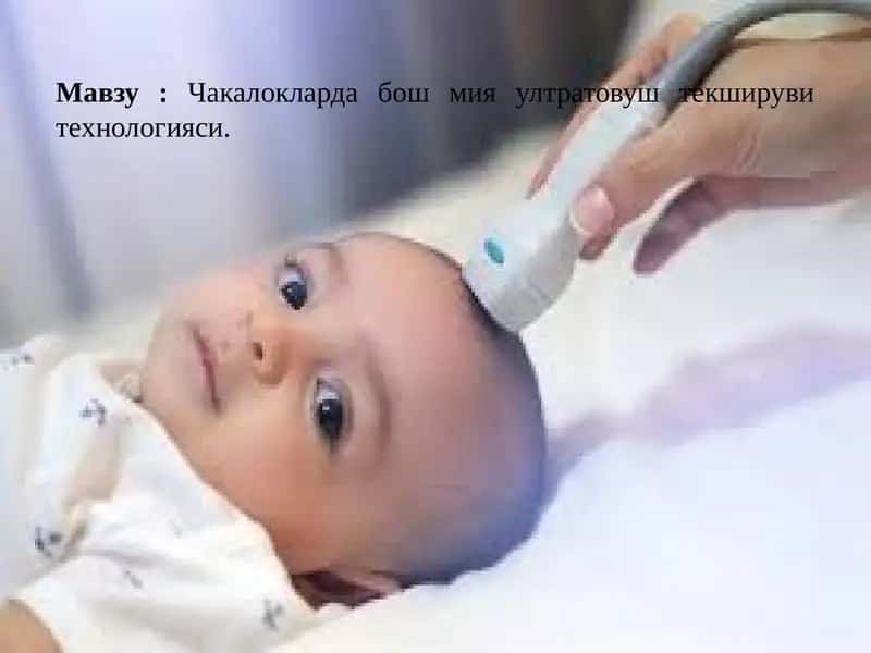 Чакалокларда бош мия ултратовуш текшируви технологияси 1