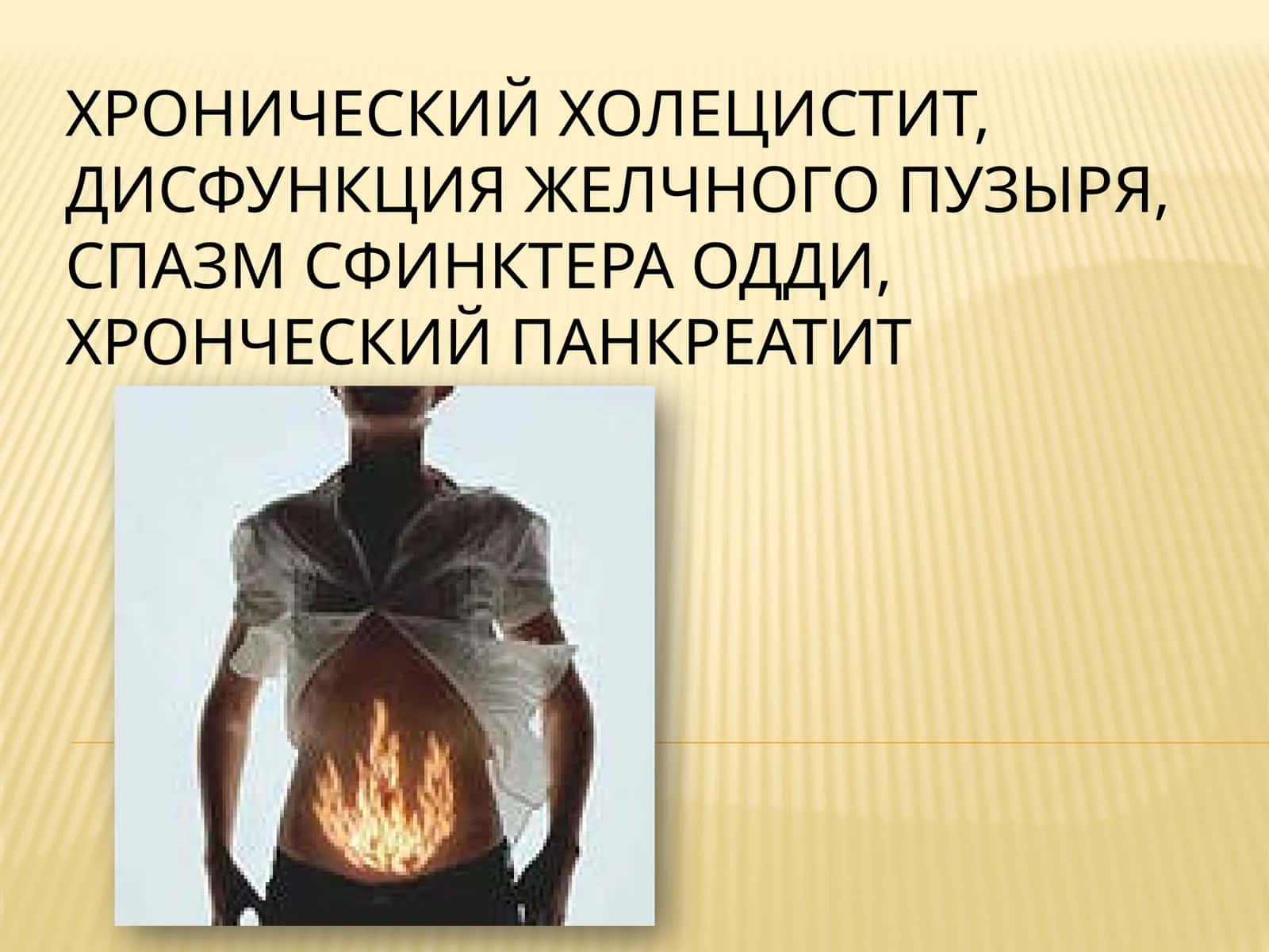 Хронический холецистит, дисфункция желчного пузыря, Спазм сфинктера Одди, хронический панкреатит 1