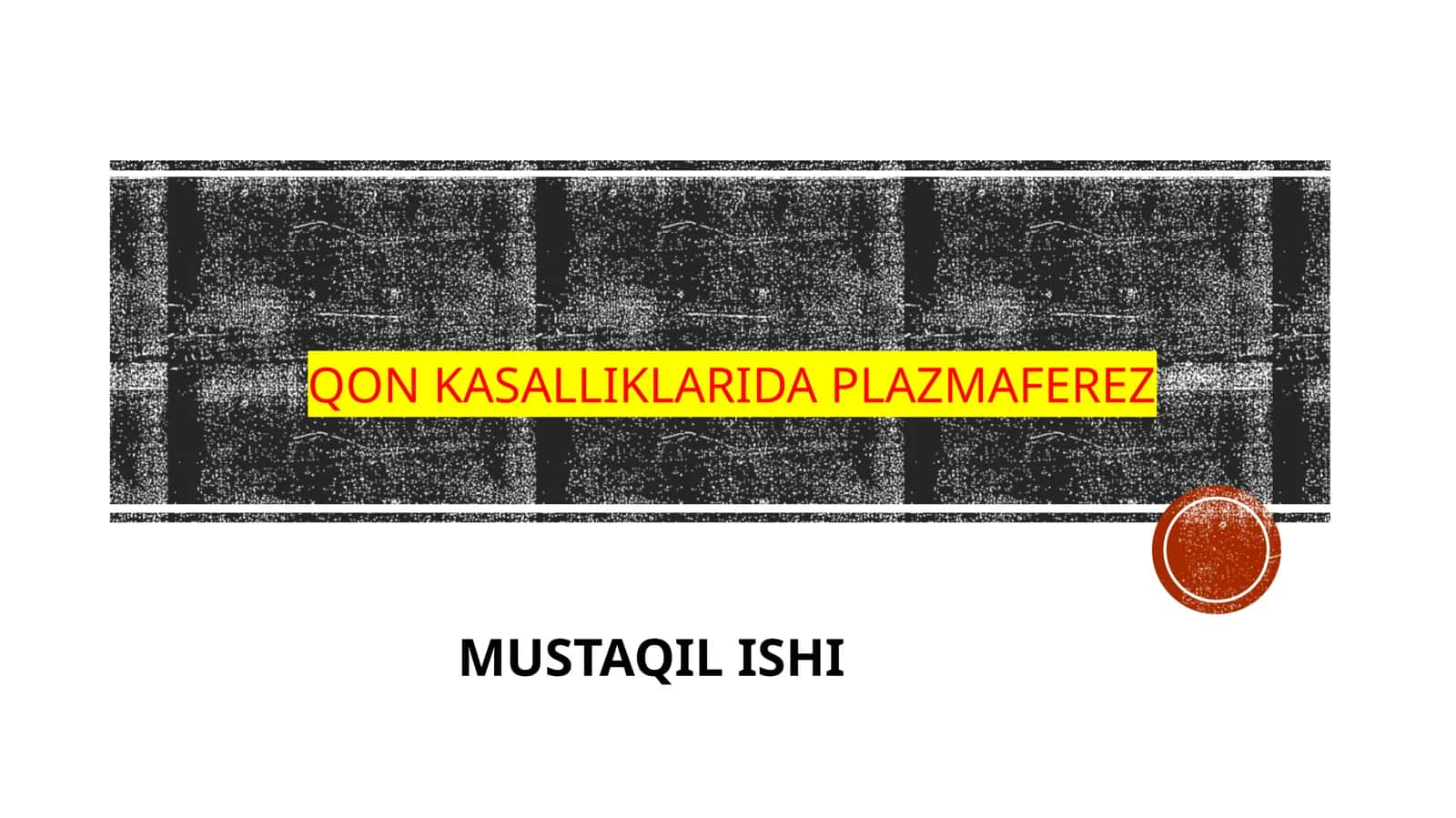 qon kasalliklari daplazmaferez 1