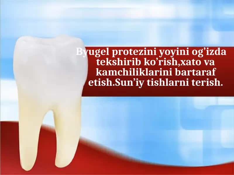 Byugel protezi 1
