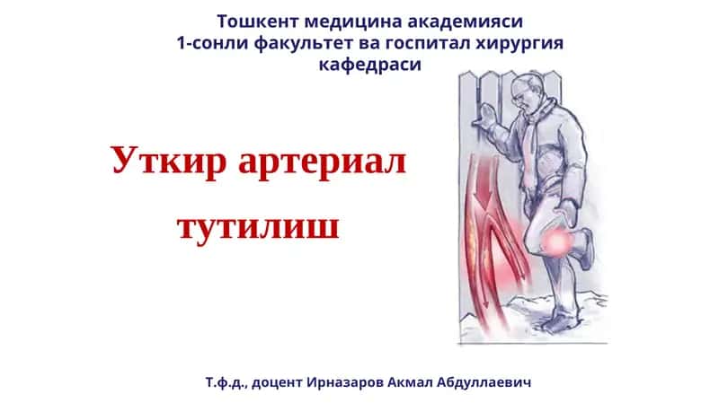 Уткир артериал тутилиш 1