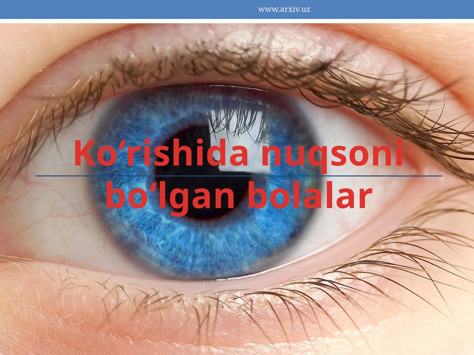 Ko‘rishida nuqsoni bo‘lgan bolalar 1