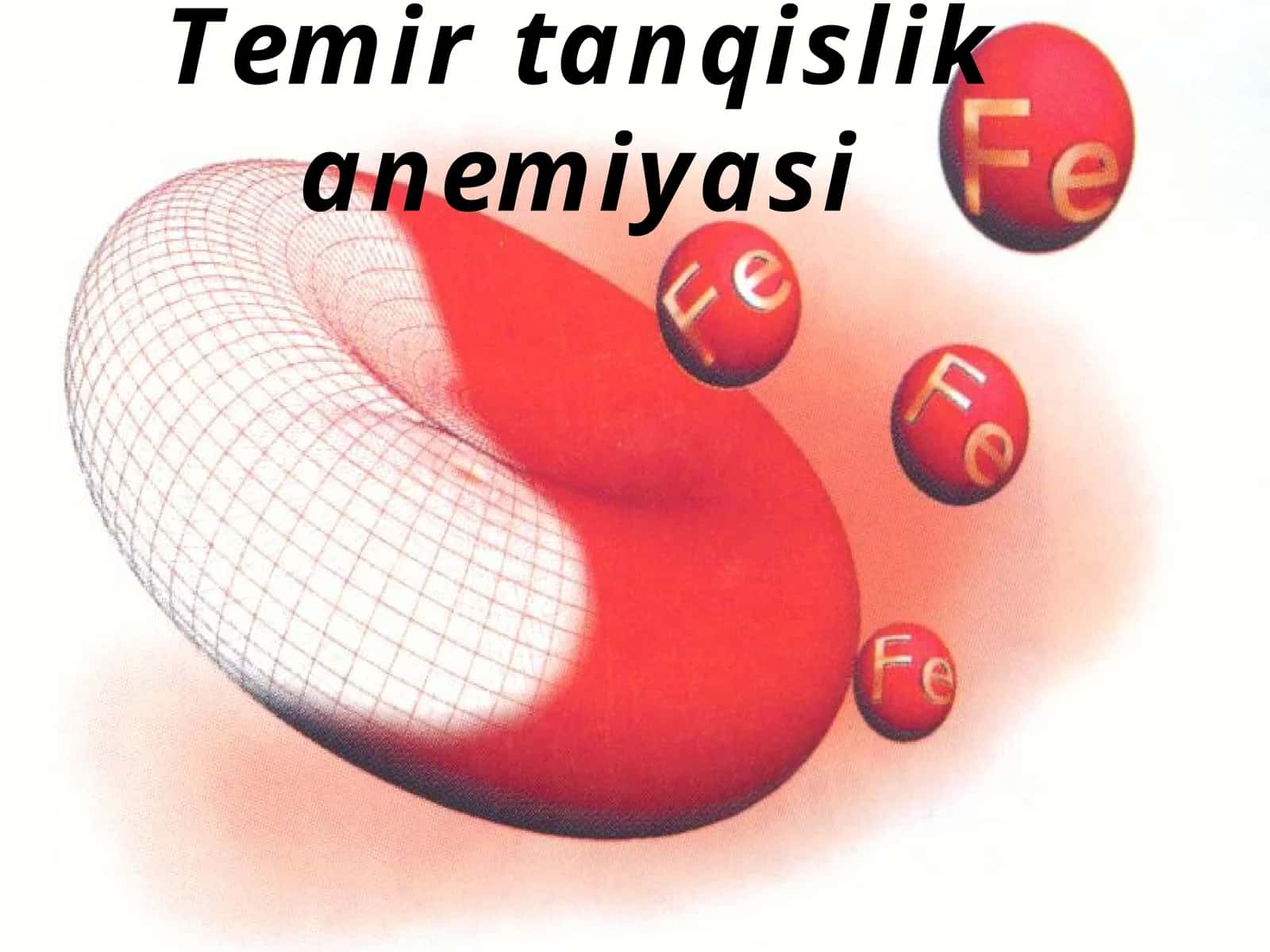 Temir tanqislik anemiyasi 1