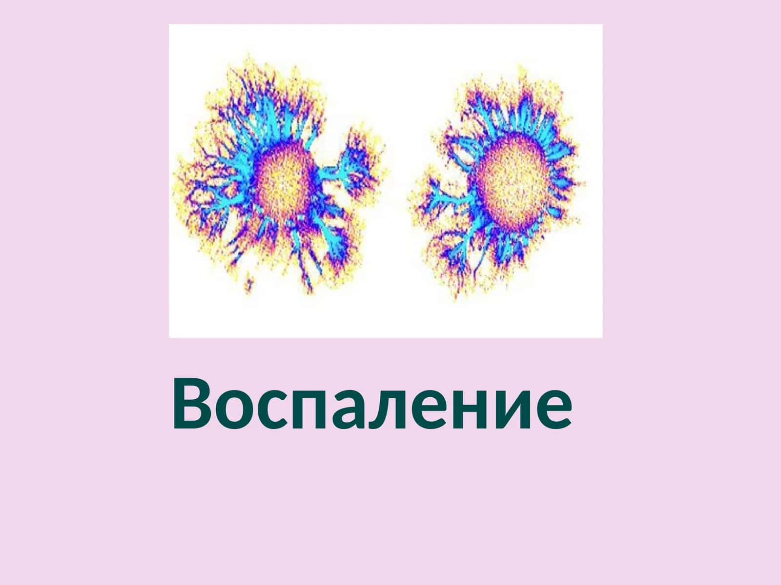 Воспаление 1