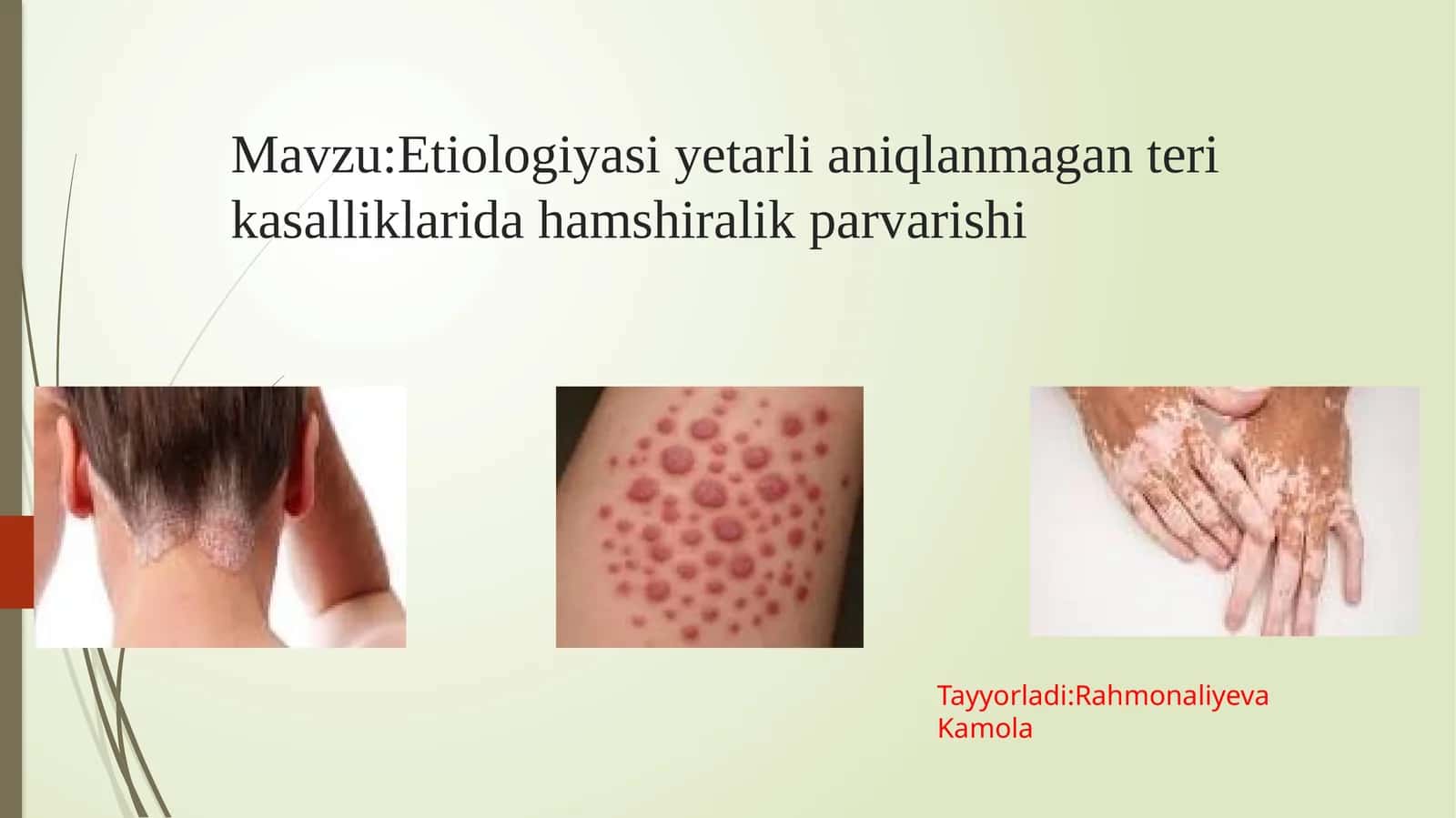 Etiologiyasi yetarli aniqlanmagan teri kasalliklarida hamshiralik parvarishi 1