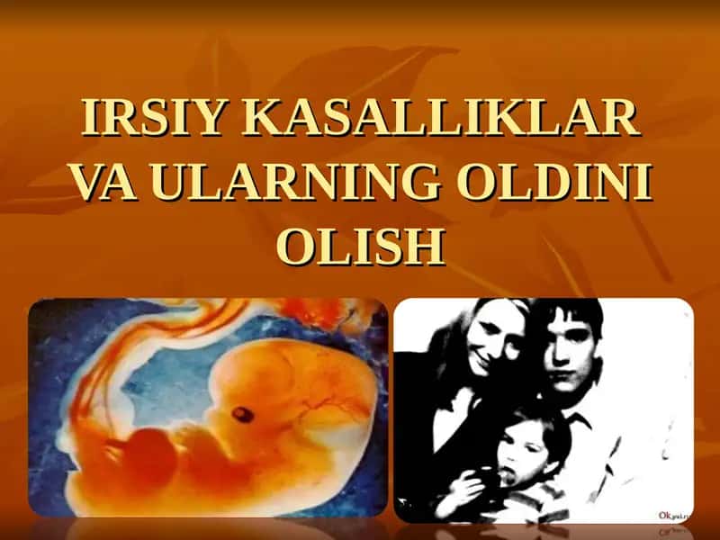 IRSIY KASALLIKLAR VA ULARNING OLDINI OLISH 1
