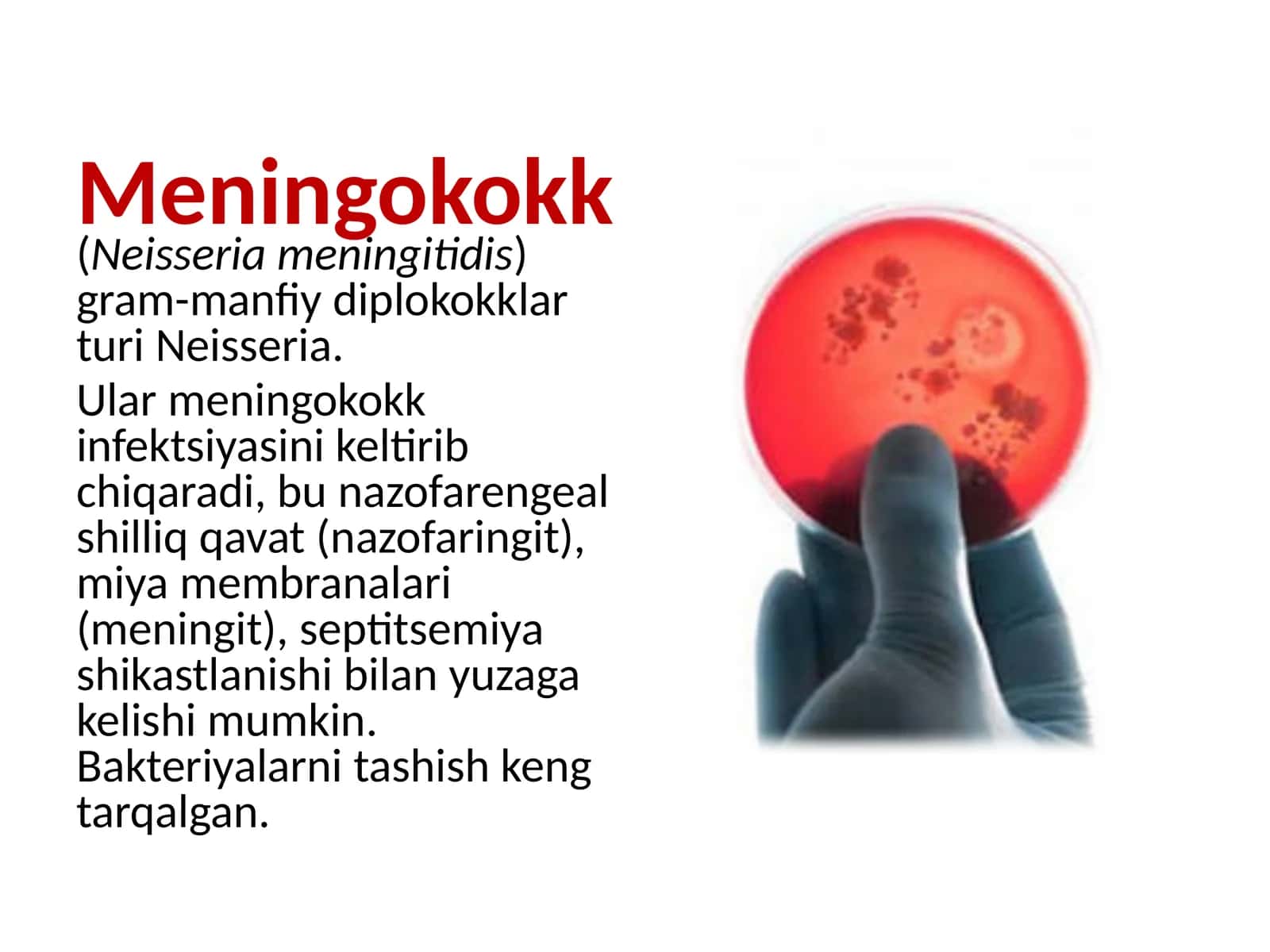 Meningokokk(Neisseria meningitidis) 1