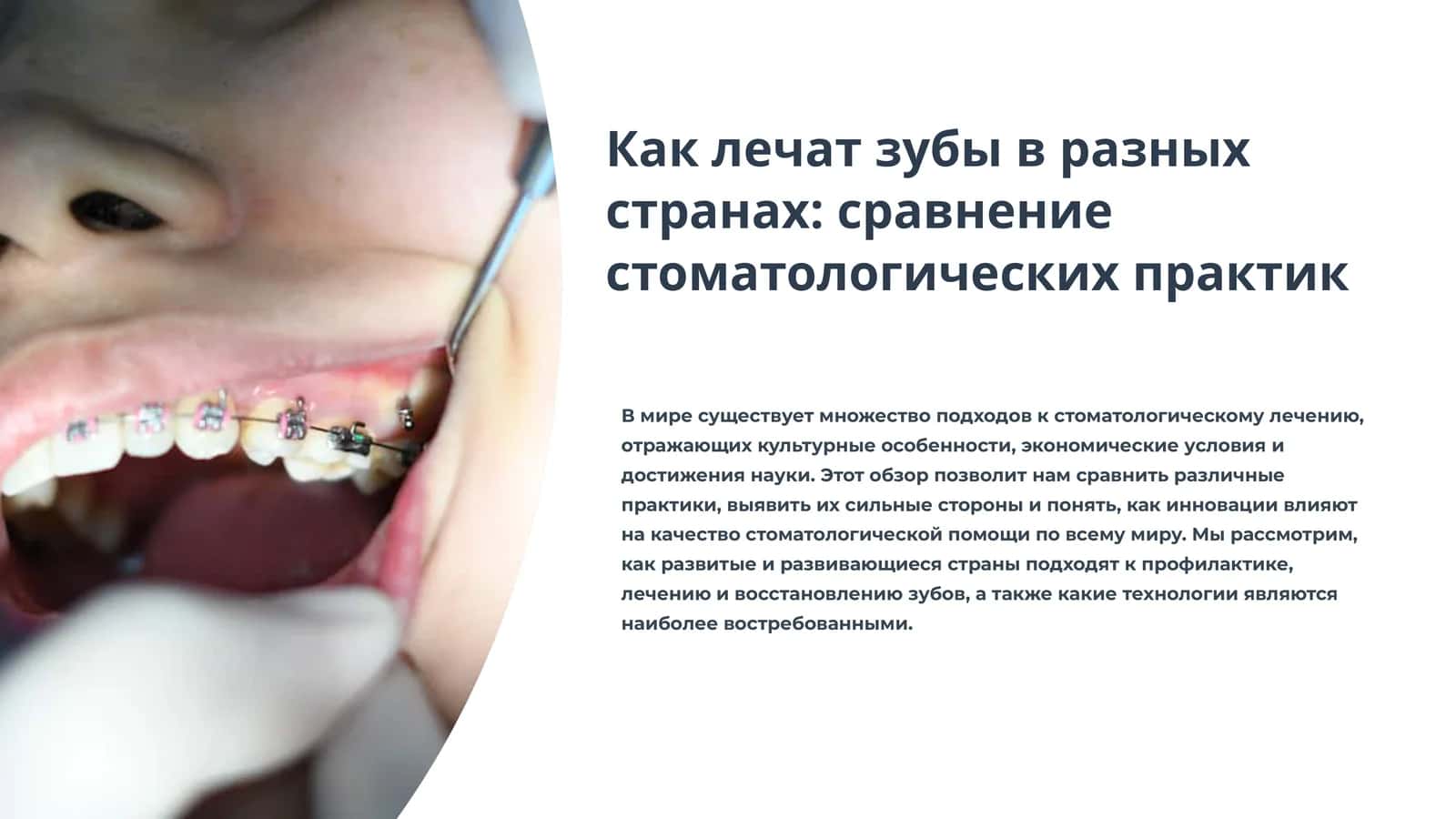 Как лечат зубы в разных странах: сравнение стоматологических практик 1