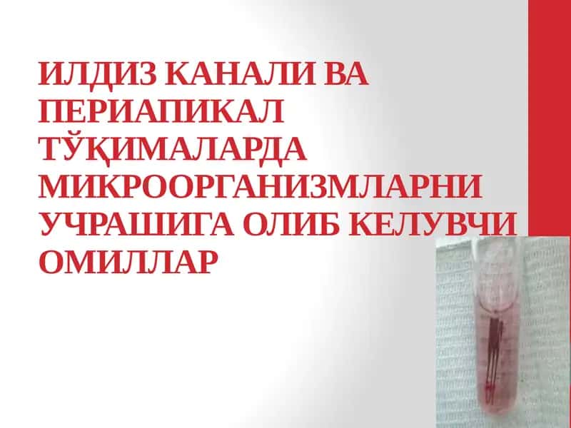 Илдиз канали ва периапикал тўқималарда микроорганизмларни учрашига олиб келувчи омиллар 1