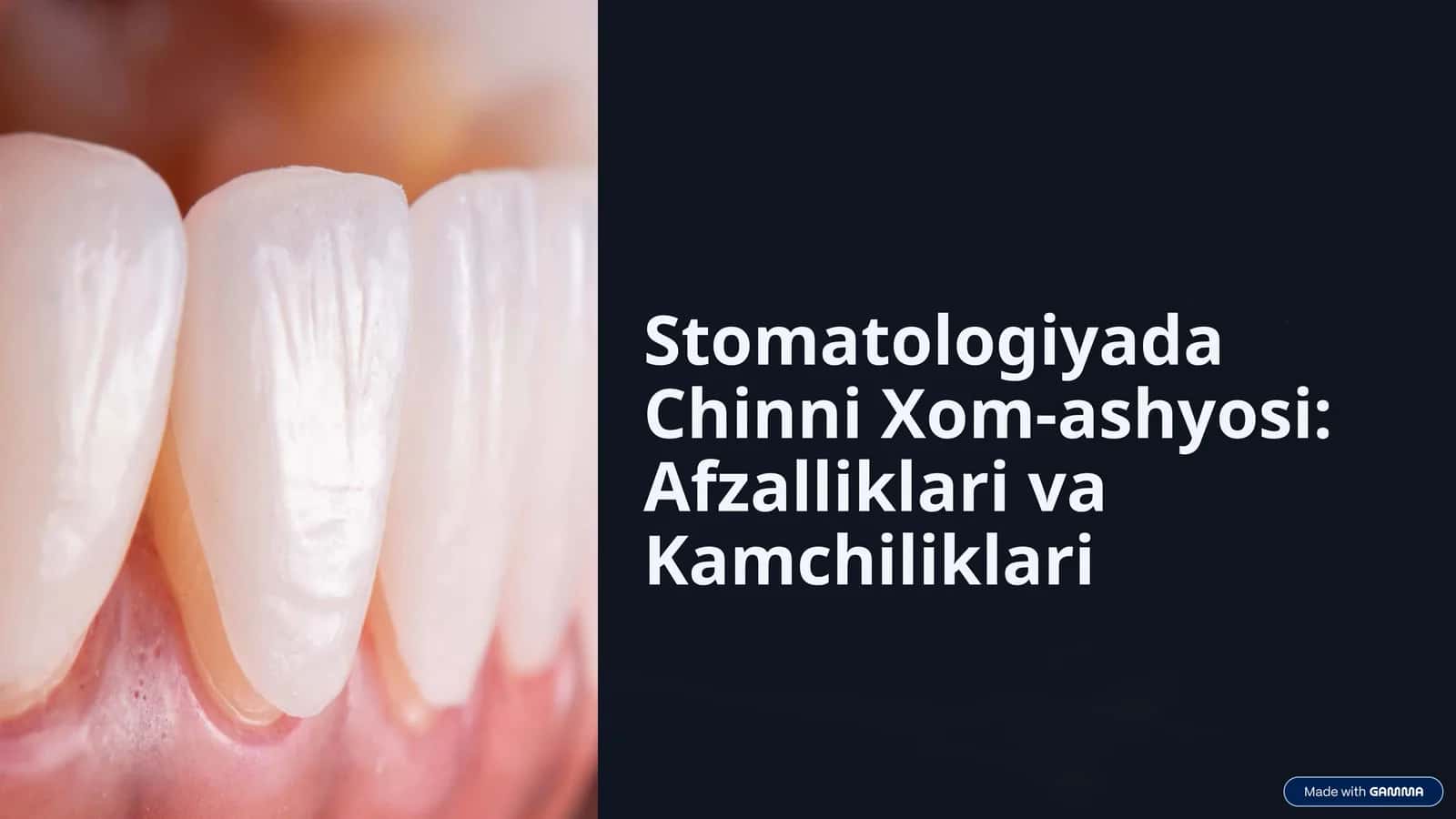 Stomatologiyada Chinni Xom-ashyosi: Afzalliklari va Kamchiliklari 1