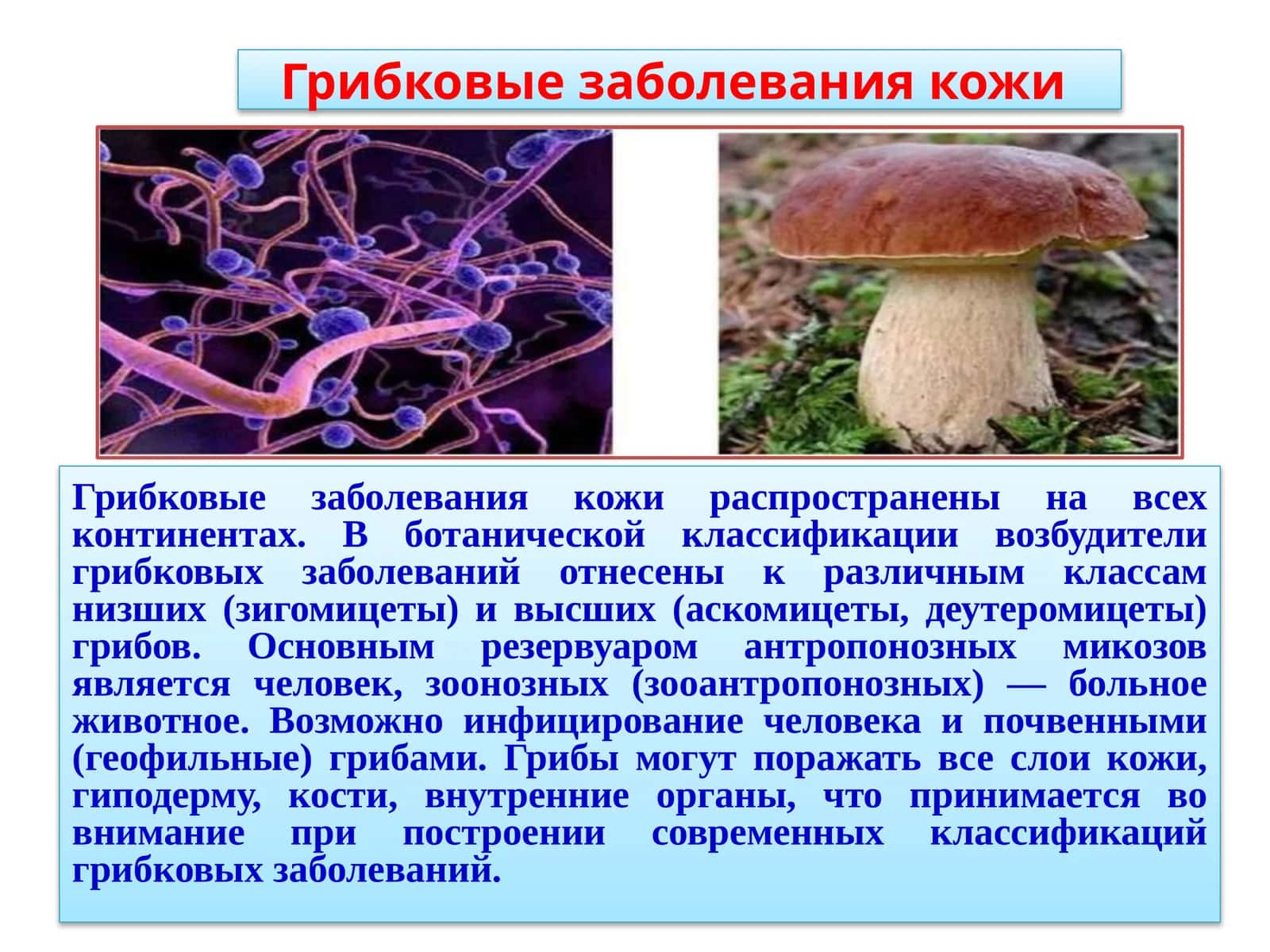 Грибковые заболевания кожи 1