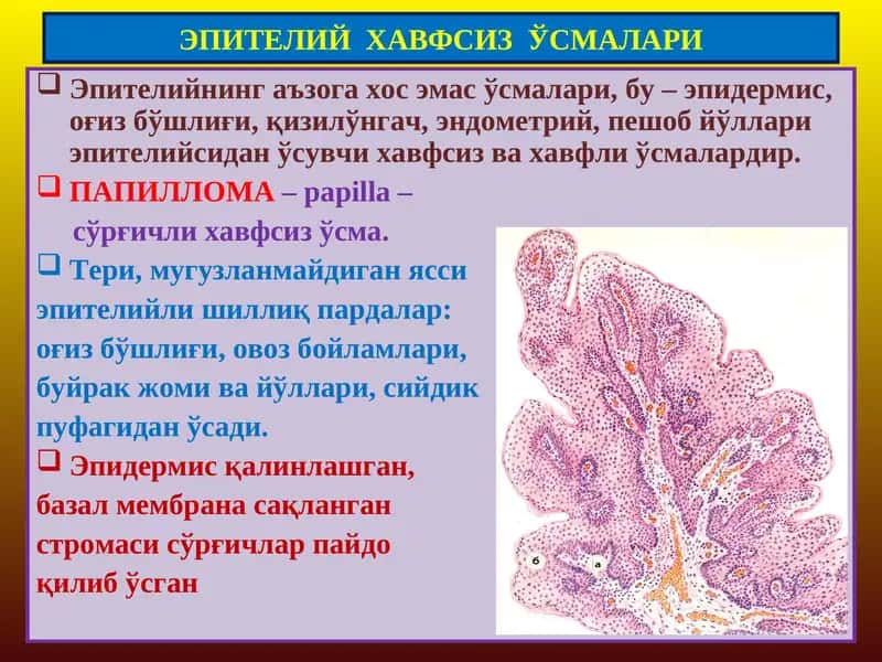 ЭПИТЕЛИЙ ХАВФСИЗЎСМАЛАРИ 1