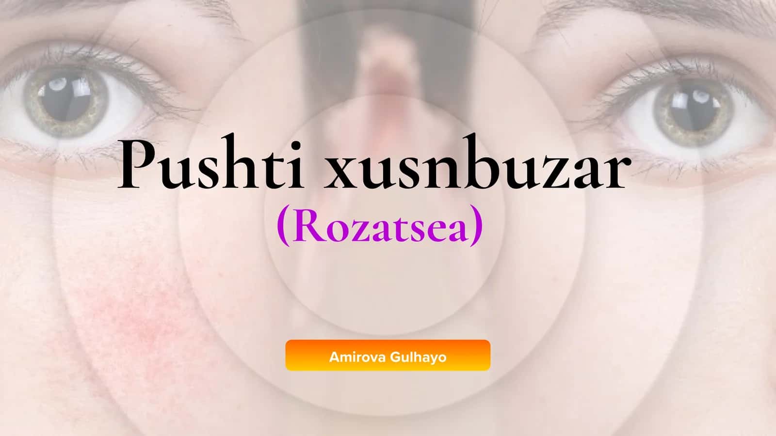 Pushti xusnbuzar (Rozatsea) 1