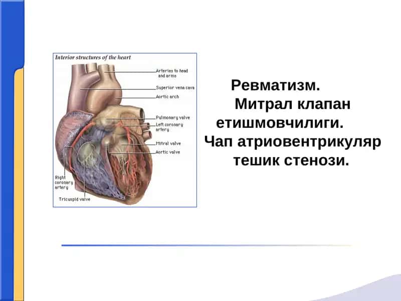 Ревматизм. Митрал клапан етишмовчилиги.Чап атриовентрикуляр тешик стенози. 1