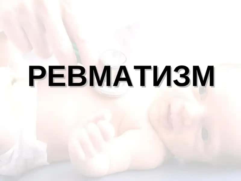 Ревматизм 1