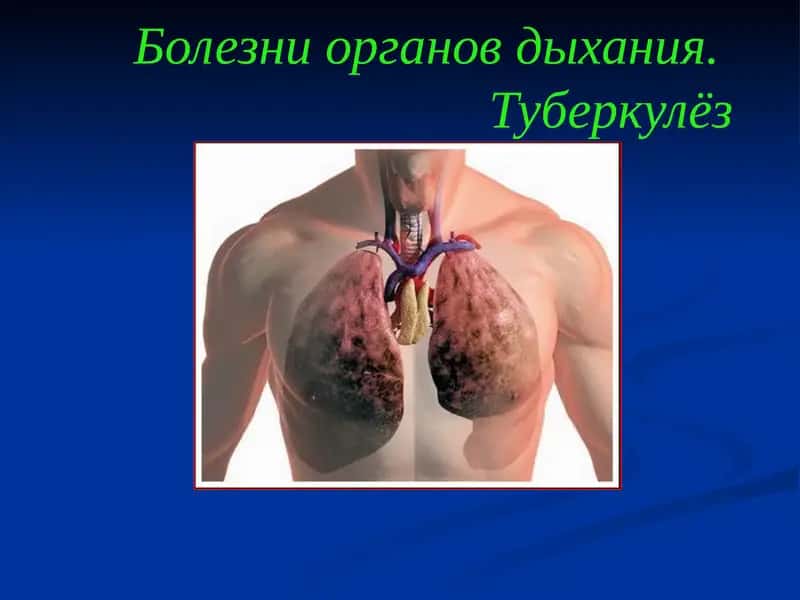 Острый бронхит (bronchitis acuta) 1