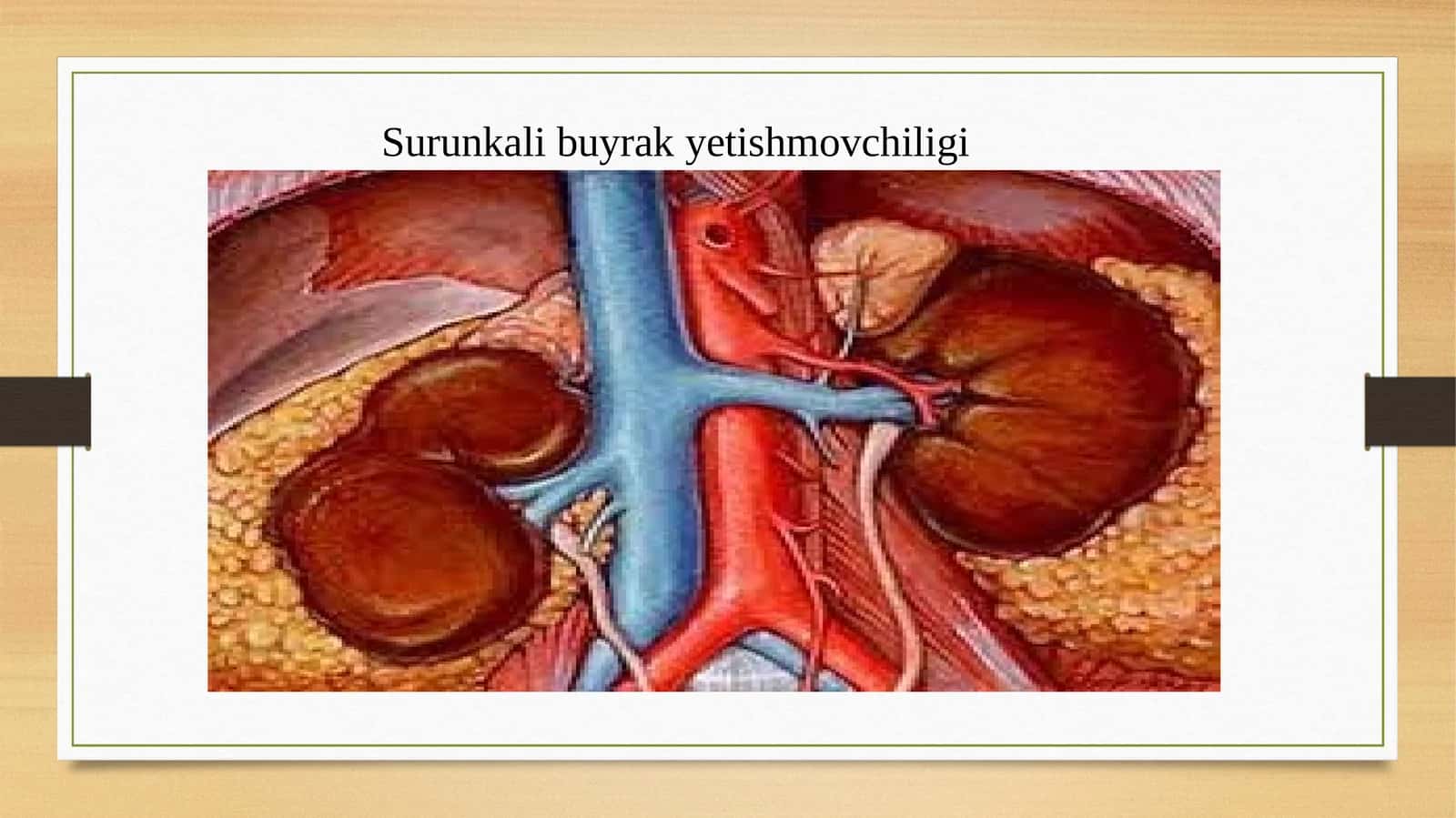 Surunkali buyrak  yetishmovchiligi 1