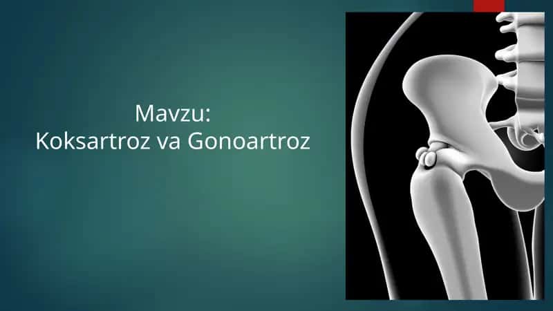 TOS-SON BO'G'IMI ANATOMIYASI Koksartroz va Gonoartroz 1