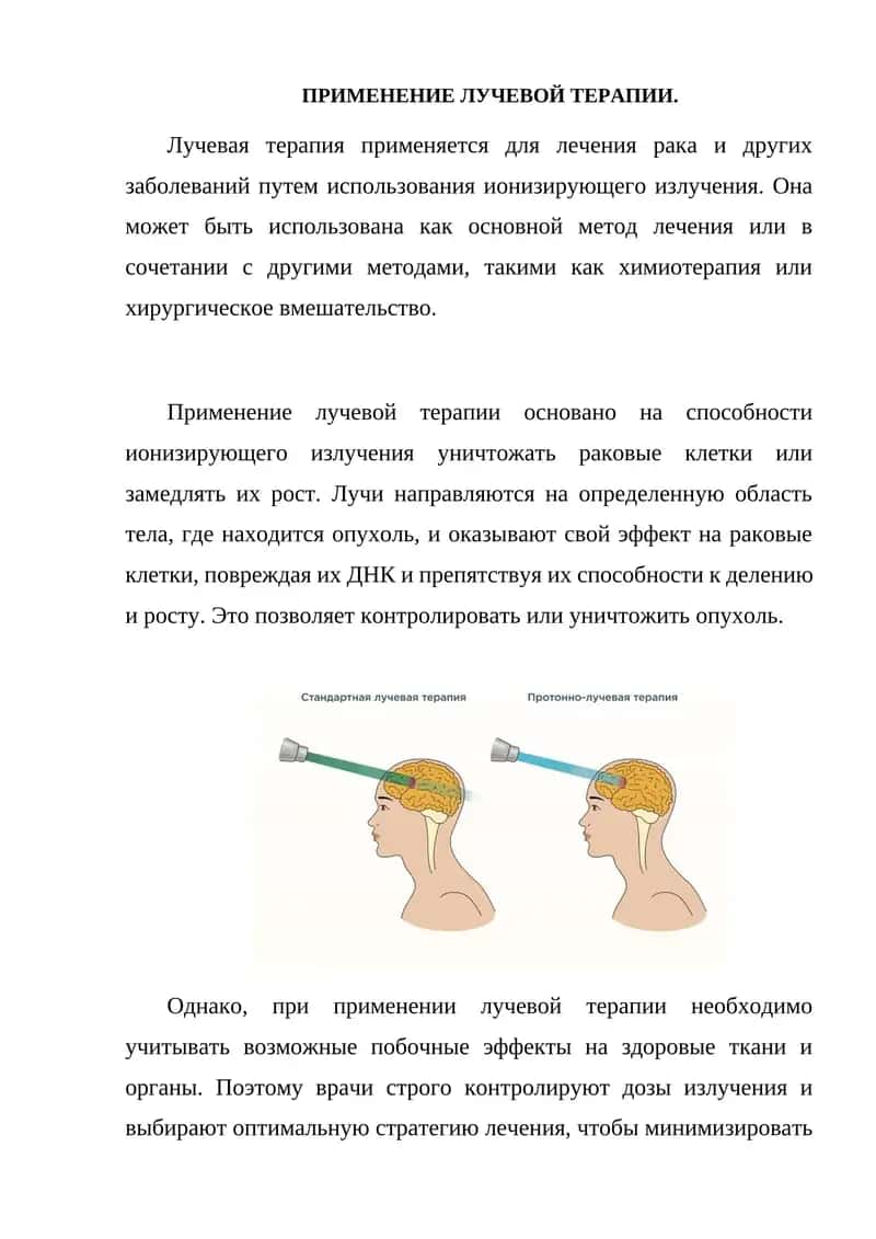 ПРИМЕНЕНИЕ ЛУЧЕВОЙ ТЕРАПИИ 1