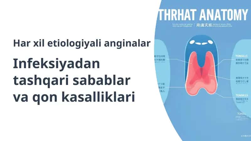 Angina: Infeksiyadan Tashqari Sabablar va Qon Kasalliklari 1