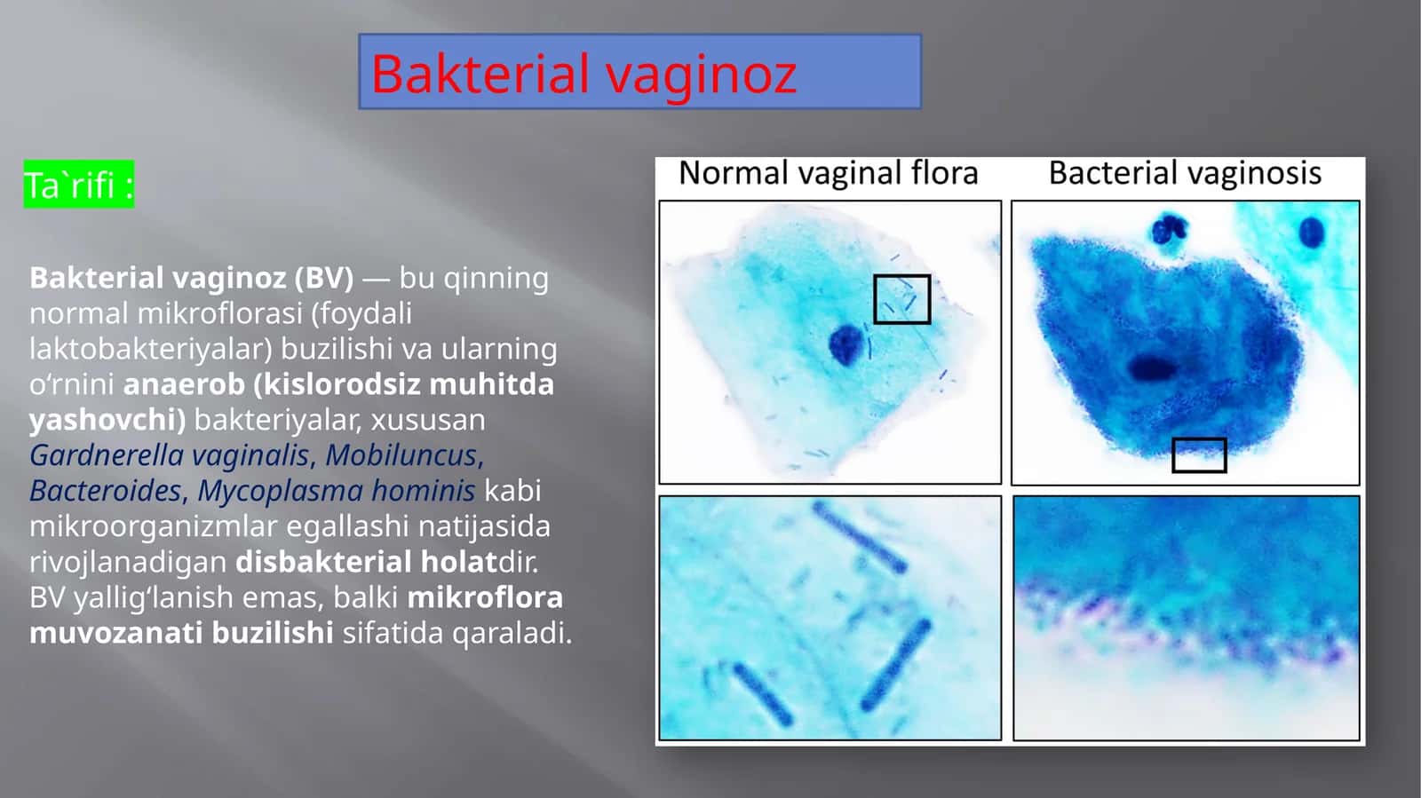 Bakterial vaginoz 1