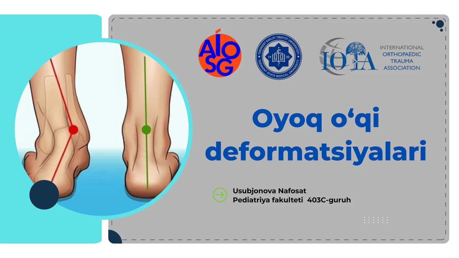 Oyoq o‘qi deformatsiyalari 1