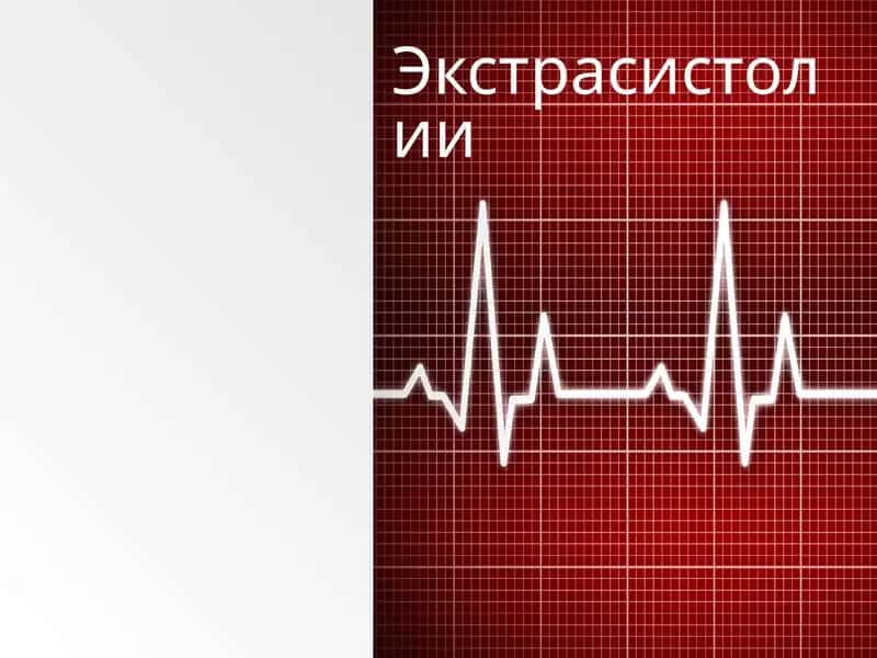 Ekstrasistoliya 1