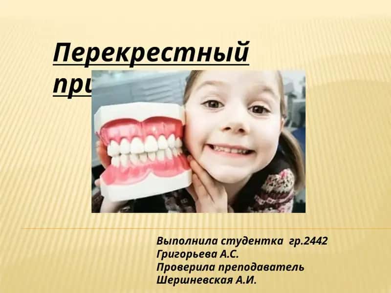 Перекрестный прикус 1